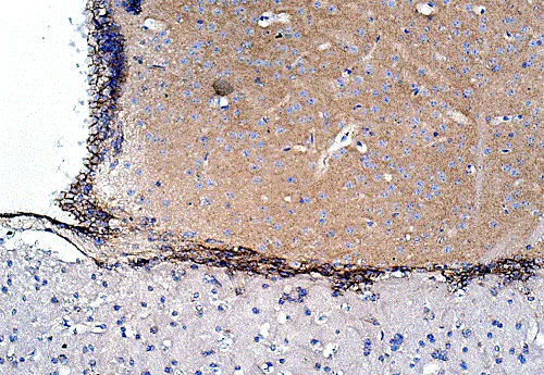 Immunohistochemistry (Formalin/PFA-fixed paraffin-embedded sections) - Anti-N Cadherin antibody - Intercellular Junction Marker (AB18203)