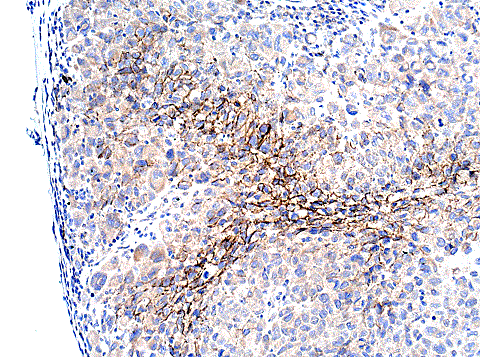 Immunohistochemistry (Formalin/PFA-fixed paraffin-embedded sections) - Anti-N Cadherin antibody - Intercellular Junction Marker (ab18203), expandable thumbnail
