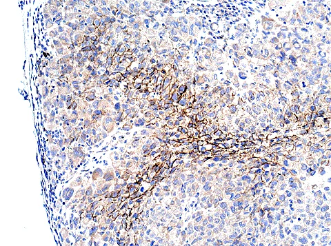 Immunohistochemistry (Formalin/PFA-fixed paraffin-embedded sections) - Anti-N Cadherin antibody - Intercellular Junction Marker (AB18203)