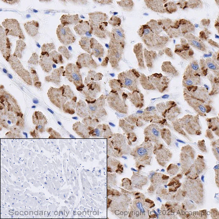 Immunohistochemistry (Formalin/PFA-fixed paraffin-embedded sections) - Anti-N Cadherin antibody - Intercellular Junction Marker (AB18203)