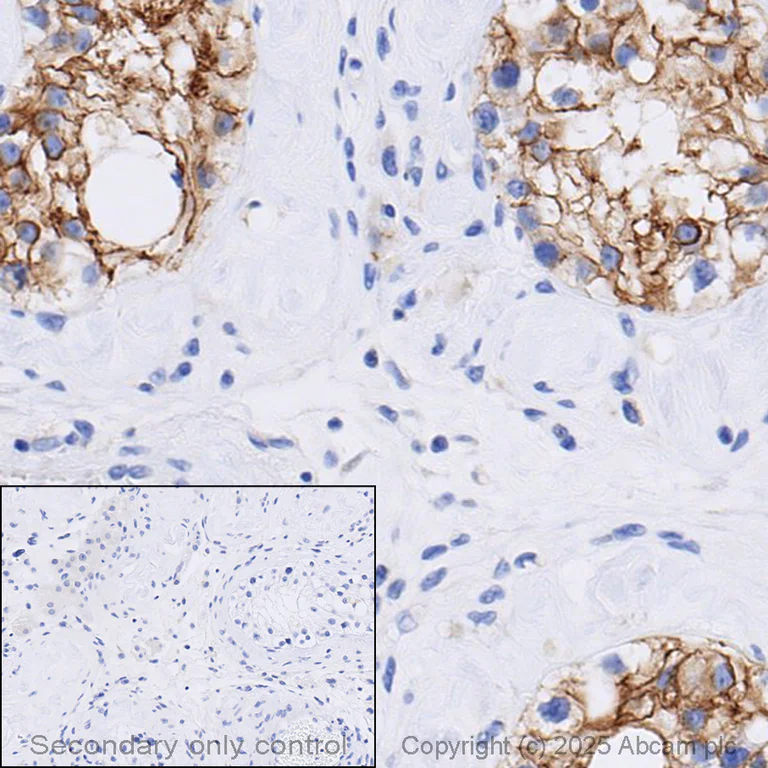 Immunohistochemistry (Formalin/PFA-fixed paraffin-embedded sections) - Anti-N Cadherin antibody - Intercellular Junction Marker (AB18203)
