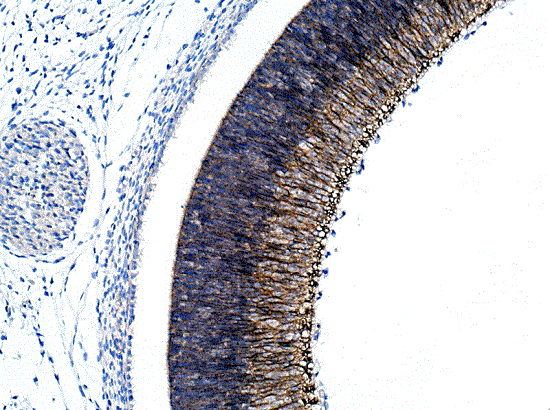 Immunohistochemistry (Formalin/PFA-fixed paraffin-embedded sections) - Anti-N Cadherin antibody - Intercellular Junction Marker (ab18203), expandable thumbnail