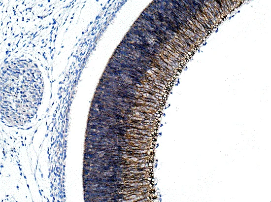 Immunohistochemistry (Formalin/PFA-fixed paraffin-embedded sections) - Anti-N Cadherin antibody - Intercellular Junction Marker (AB18203)