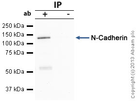 Immunoprecipitation - Anti-N Cadherin antibody - Intercellular Junction Marker (AB18203), expandable thumbnail