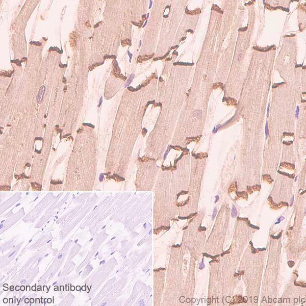 Immunohistochemistry (Formalin/PFA-fixed paraffin-embedded sections) - Anti-N Cadherin antibody [SP90] - BSA and Azide free (AB240403)