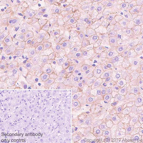 Immunohistochemistry (Formalin/PFA-fixed paraffin-embedded sections) - Anti-N Cadherin antibody [SP90] - BSA and Azide free (AB240403)