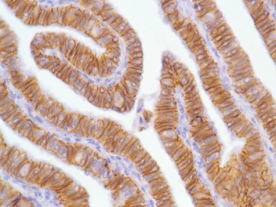 Immunohistochemistry (Formalin/PFA-fixed paraffin-embedded sections) - Anti-N Cadherin antibody [SP90] - BSA and Azide free (AB240403)