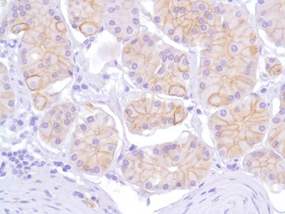 Immunohistochemistry (Formalin/PFA-fixed paraffin-embedded sections) - Anti-N Cadherin antibody [SP90] - BSA and Azide free (AB240403)