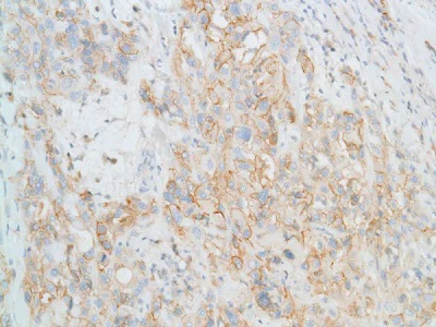 Immunohistochemistry (Formalin/PFA-fixed paraffin-embedded sections) - Anti-N Cadherin antibody [SP90] - BSA and Azide free (AB240403)
