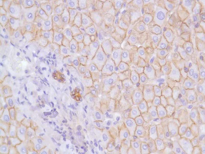 Immunohistochemistry (Formalin/PFA-fixed paraffin-embedded sections) - Anti-N Cadherin antibody [SP90] - BSA and Azide free (AB240403)