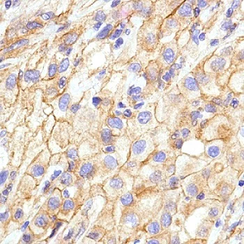 Immunohistochemistry (Formalin/PFA-fixed paraffin-embedded sections) - Anti-N Cadherin antibody [SP90] - BSA and Azide free (AB240403)