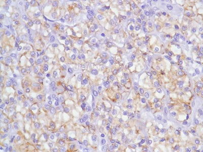 Immunohistochemistry (Formalin/PFA-fixed paraffin-embedded sections) - Anti-N Cadherin antibody [SP90] - BSA and Azide free (AB240403)