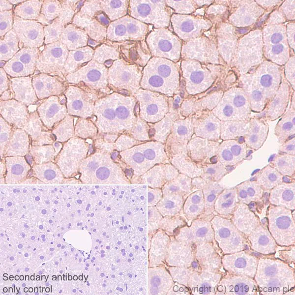 Immunohistochemistry (Formalin/PFA-fixed paraffin-embedded sections) - Anti-N Cadherin antibody [SP90] - C-terminal (AB225719)