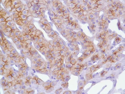 Immunohistochemistry (Formalin/PFA-fixed paraffin-embedded sections) - Anti-N Cadherin antibody [SP90] - C-terminal (AB225719)