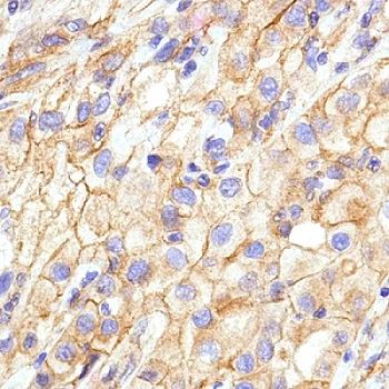Immunohistochemistry (Formalin/PFA-fixed paraffin-embedded sections) - Anti-N Cadherin antibody [SP90] - C-terminal (AB225719)