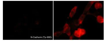 Immunocytochemistry - Anti-N Cadherin (phospho Y860) antibody (AB119752)