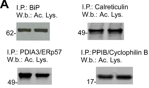 Western blot - Anti-N-epsilon acetyl Lysine antibody [11A1] (AB409)
