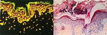 Immunohistochemistry (Formalin/PFA-fixed paraffin-embedded sections) - Anti-N epsilon gamma glutamyl Lysine antibody [81D4] (AB424)