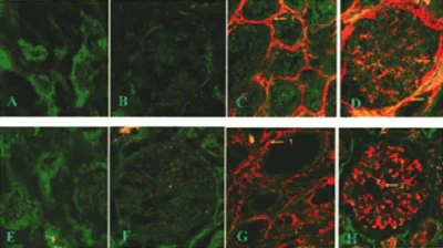 Immunohistochemistry (Frozen sections) - Anti-N epsilon gamma glutamyl Lysine antibody [81D4] (AB424)