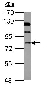 Western blot - Anti-N-ethylmaleimide-sensitive fusion protein antibody (AB126202), expandable thumbnail