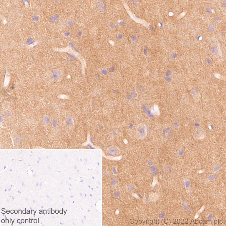Immunohistochemistry - Anti-N-ethylmaleimide-sensitive fusion protein antibody [EPR25190-1] (AB302788)