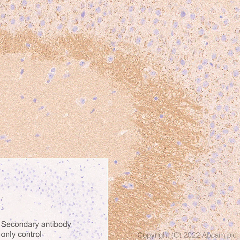 Immunohistochemistry - Anti-N-ethylmaleimide-sensitive fusion protein antibody [EPR25190-1] (AB302788)