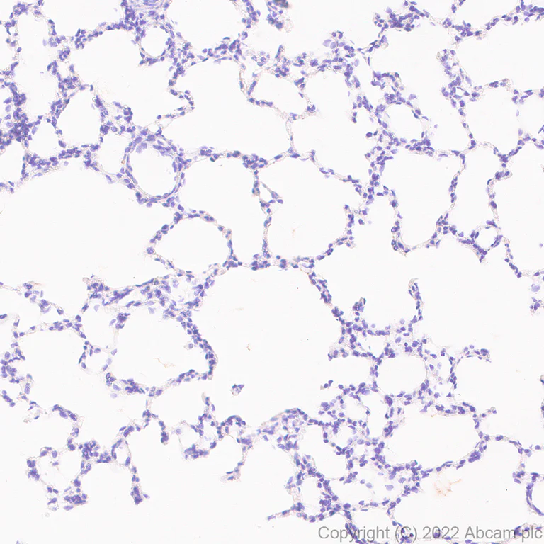 Immunohistochemistry - Anti-N-ethylmaleimide-sensitive fusion protein antibody [EPR25190-1] (AB302788)