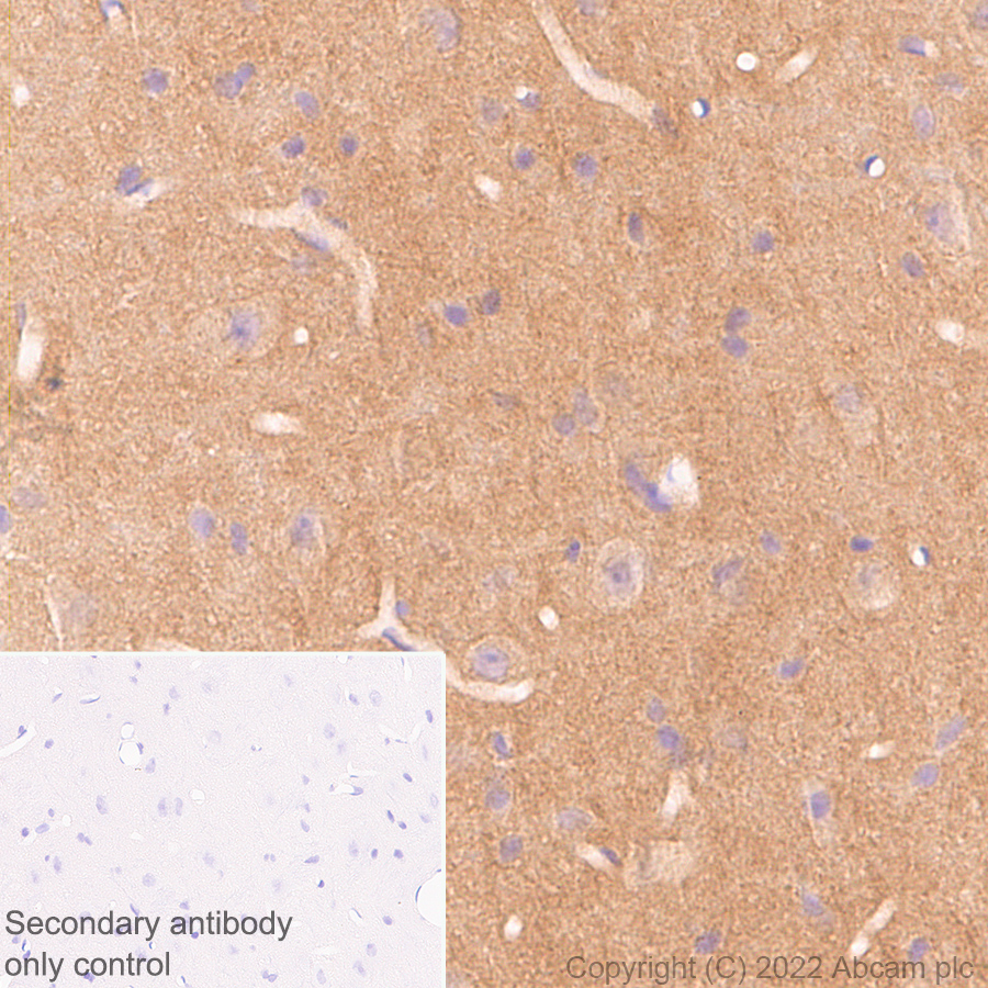 Immunohistochemistry - Anti-N-ethylmaleimide-sensitive fusion protein antibody [EPR25190-1] - BSA and Azide free (AB302789), expandable thumbnail