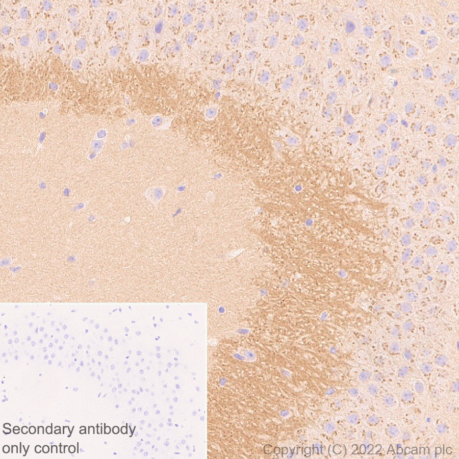 Immunohistochemistry - Anti-N-ethylmaleimide-sensitive fusion protein antibody [EPR25190-1] - BSA and Azide free (AB302789), expandable thumbnail