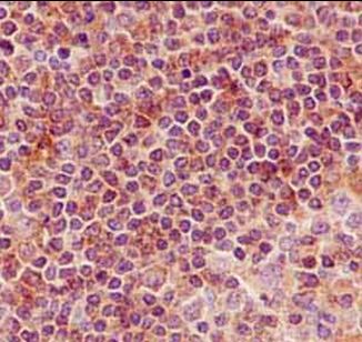 Immunohistochemistry (Formalin/PFA-fixed paraffin-embedded sections) - Anti-N myc interactor/NMI antibody [EPR11065(2)] (AB183724)