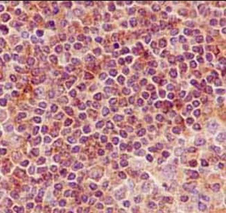 Immunohistochemistry (Formalin/PFA-fixed paraffin-embedded sections) - Anti-N myc interactor/NMI antibody [EPR11065(2)] (AB183724)