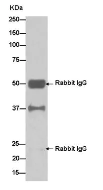 Immunoprecipitation - Anti-N myc interactor/NMI antibody [EPR11065(2)] - BSA and Azide free (AB250698)