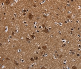 Immunohistochemistry (Formalin/PFA-fixed paraffin-embedded sections) - Anti-n-Myc/MYCN antibody (AB198912)