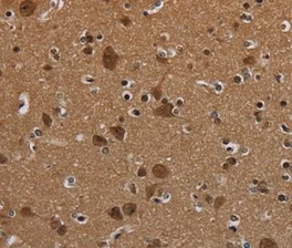 Immunohistochemistry (Formalin/PFA-fixed paraffin-embedded sections) - Anti-n-Myc/MYCN antibody (AB198912)