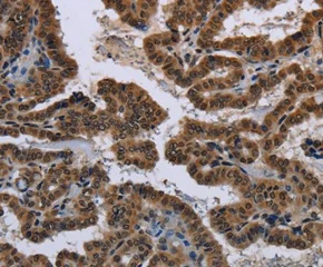 Immunohistochemistry (Formalin/PFA-fixed paraffin-embedded sections) - Anti-n-Myc/MYCN antibody (AB198912)