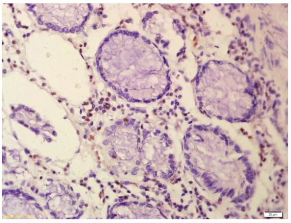 Immunohistochemistry (Formalin/PFA-fixed paraffin-embedded sections) - Anti-n-Myc/MYCN antibody (AB217873)