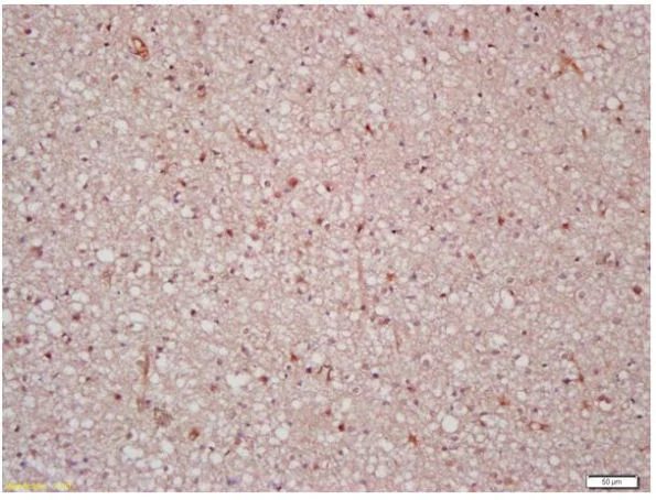 Immunohistochemistry (Formalin/PFA-fixed paraffin-embedded sections) - Anti-n-Myc/MYCN antibody (AB217873)