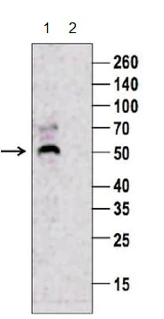 Western blot - Anti-n-Myc/MYCN antibody (AB217873)