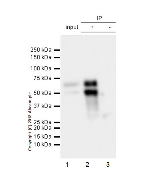 Immunoprecipitation - Anti-n-Myc/MYCN antibody [EPR18982-8R-3] - BSA and Azide free (AB236459)