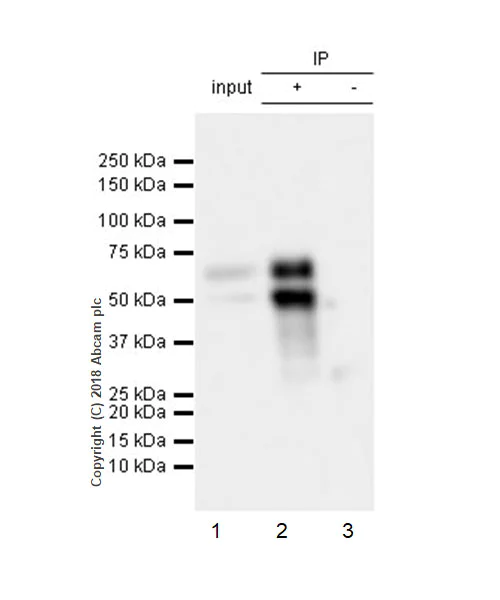 Immunoprecipitation - Anti-n-Myc/MYCN antibody [EPR18982-8R-3] - ChIP Grade (AB227822)
