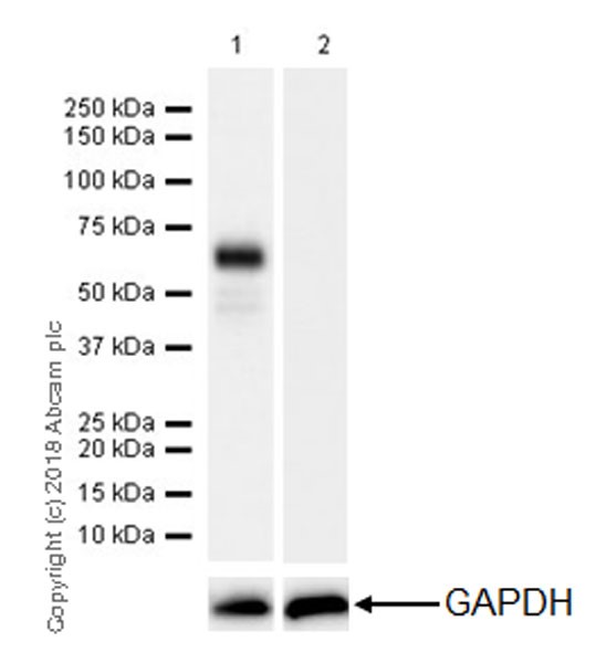 Western blot - Anti-n-Myc/MYCN antibody [EPR18982-8R-3] - ChIP Grade (AB227822), expandable thumbnail