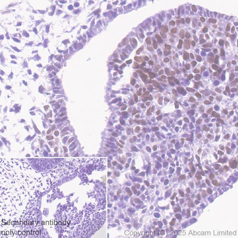 Immunohistochemistry (Formalin/PFA-fixed paraffin-embedded sections) - Anti-n-Myc/MYCN antibody [EPR26107-153] (AB325641)