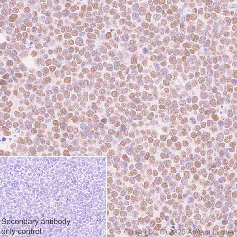 Immunohistochemistry (Formalin/PFA-fixed paraffin-embedded sections) - Anti-n-Myc/MYCN antibody [EPR26107-153] (AB325641)
