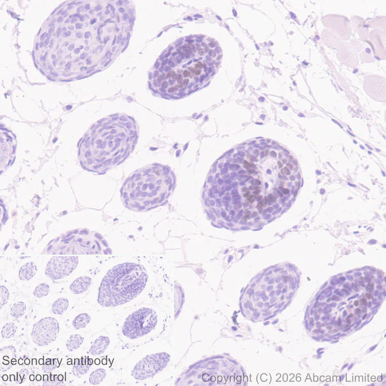 Immunohistochemistry (Formalin/PFA-fixed paraffin-embedded sections) - Anti-n-Myc/MYCN antibody [EPR26107-153] - BSA and Azide free (AB325653)