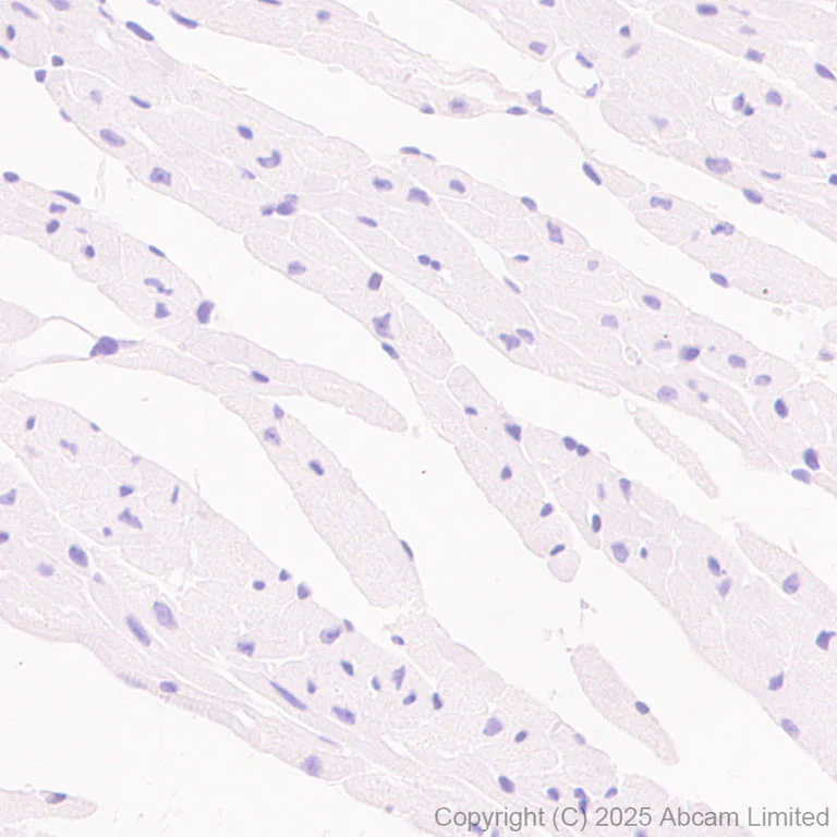 Immunohistochemistry (Formalin/PFA-fixed paraffin-embedded sections) - Anti-n-Myc/MYCN antibody [EPR26107-153] - BSA and Azide free (AB325653)