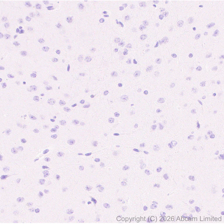 Immunohistochemistry (Formalin/PFA-fixed paraffin-embedded sections) - Anti-n-Myc/MYCN antibody [EPR26107-153] - BSA and Azide free (AB325653)