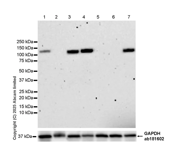 Western blot - Anti-N-terminal LPHN2 antibody [EPR29557-9] (AB324484)