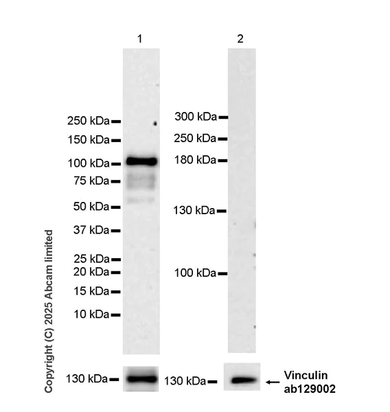 Western blot - Anti-N-terminal LPHN2 antibody [EPR29557-9] (AB324484)