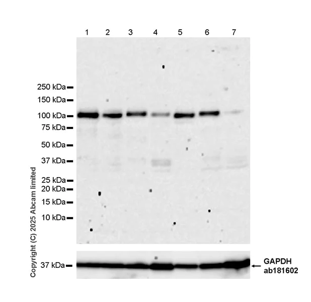 Western blot - Anti-N-terminal LPHN2 antibody [EPR29557-9] (AB324484)