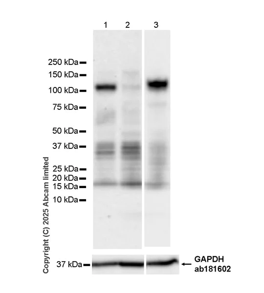 Western blot - Anti-N-terminal LPHN2 antibody [EPR29557-9] (AB324484)